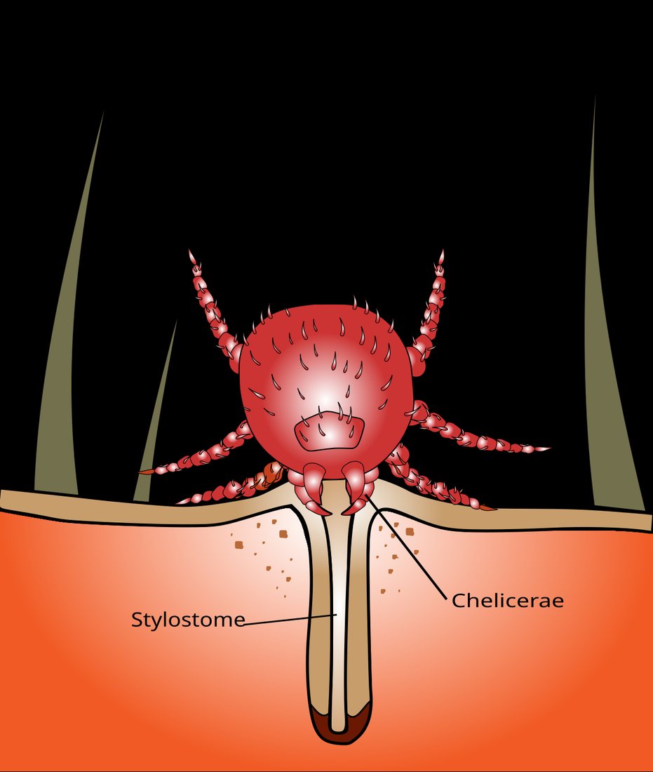 Diagram of a chigger on the skin surface with a narrow tube extending down into the skin, labelled stylostome and chelicerae