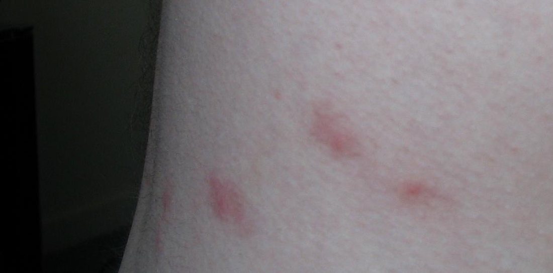 Pale skin with four small red spots clustered within a few centimetres of each other