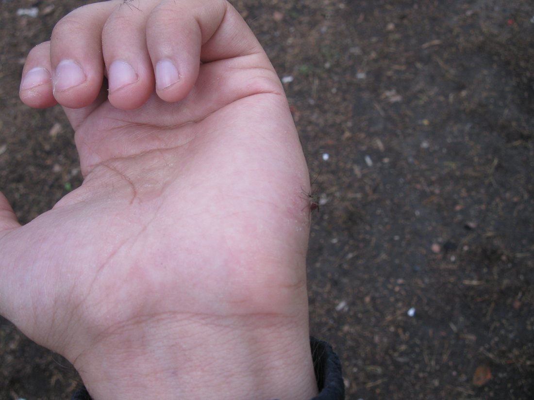 A mosquito standing on the skin of a human hand with its mouthparts inserted, seen from the side