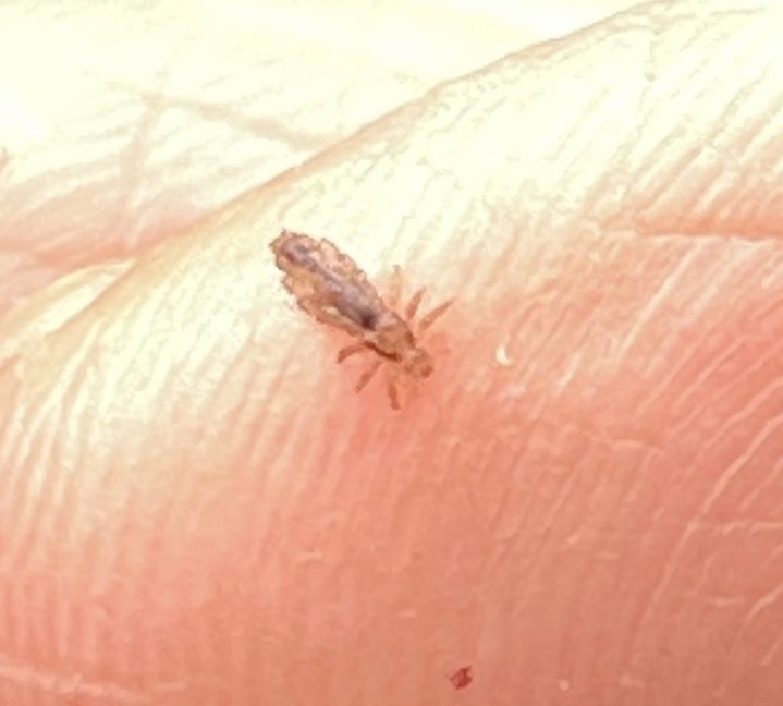 Pediculus humanus capitis, the insect that causes a head lice bites